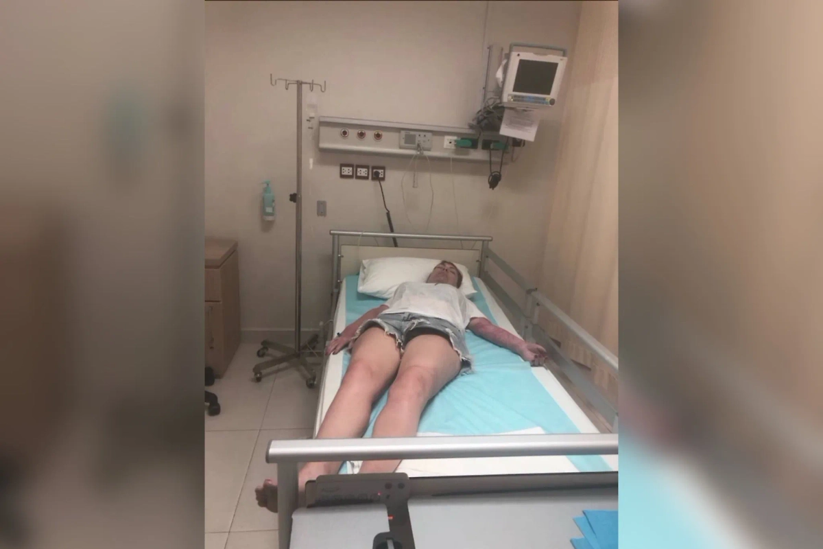 Иркутянка получила анафилактический шок после укуса ядовитой медузы во Вьетнаме. Фото © Telegram / Thai_Maman_red