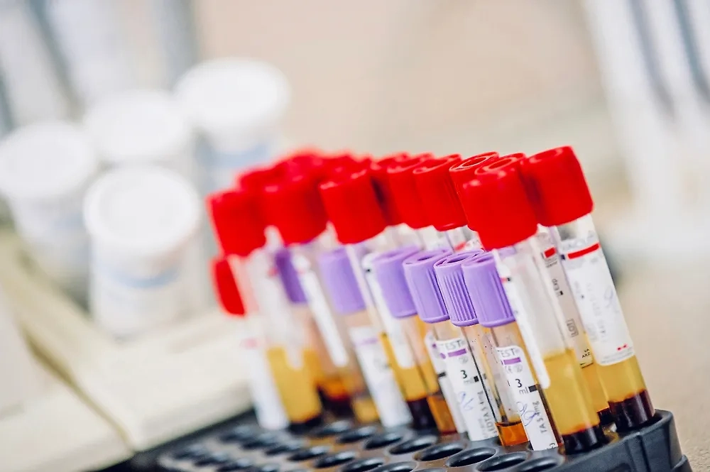 Исследование на краснуху ПЦР-методом. Фото © Shutterstock / FOTODOM / Olha Yefimova