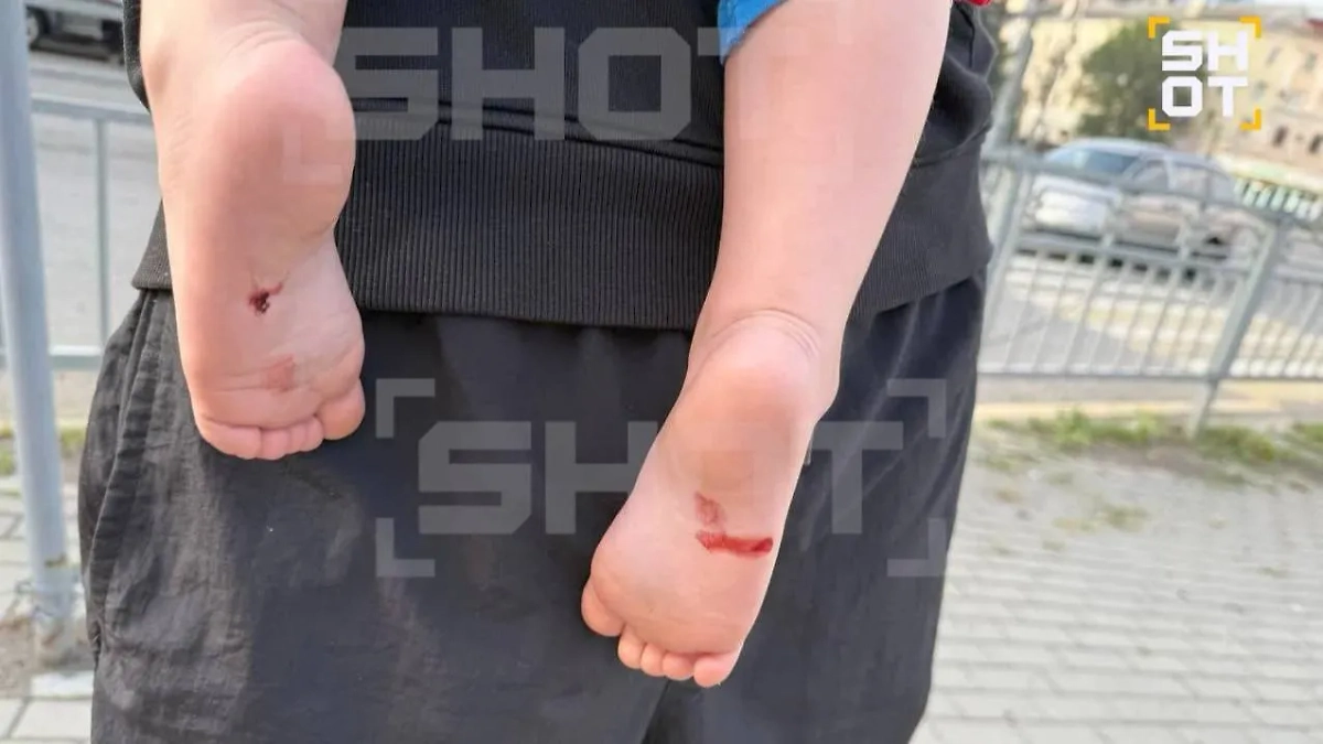 Годовалый мальчик пострадал в результате падения обломков БПЛА ВСУ в Воронеже. Фото © SHOT