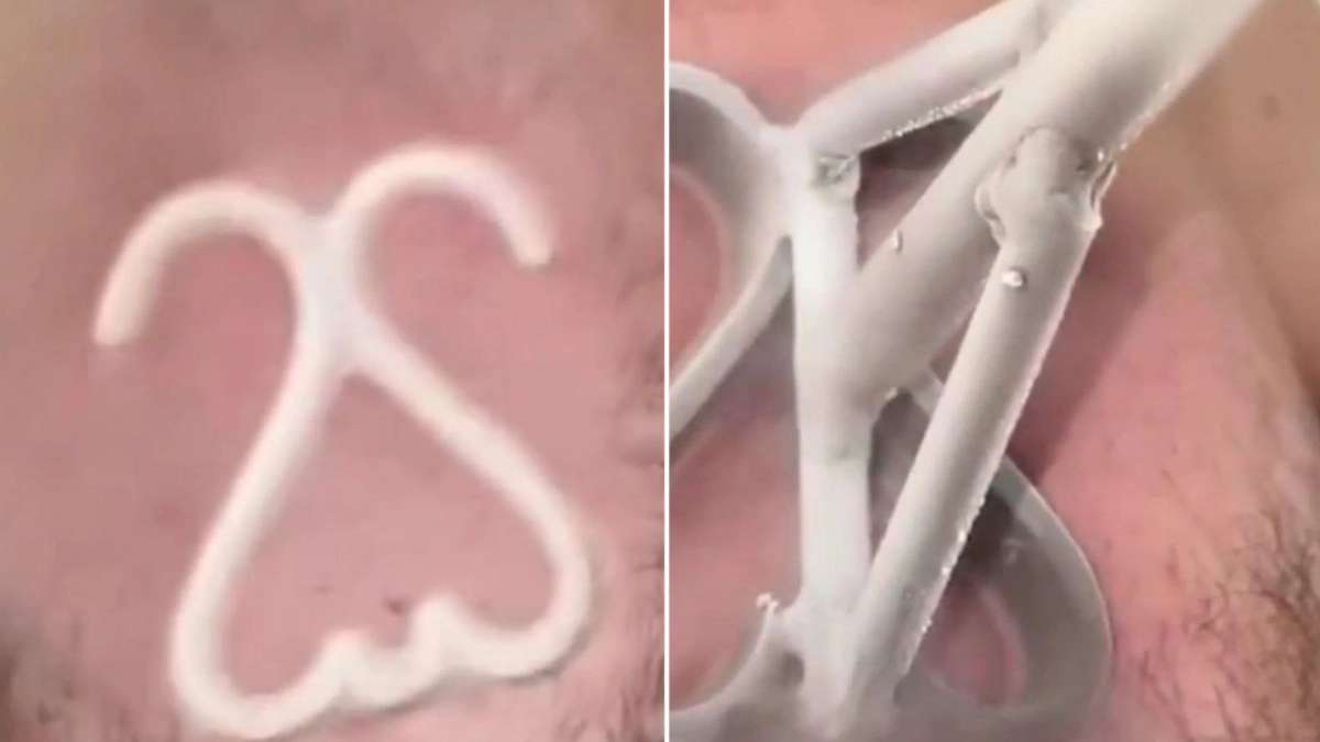 «Холодная» татуировка. Обложка © Х / @DoctorER