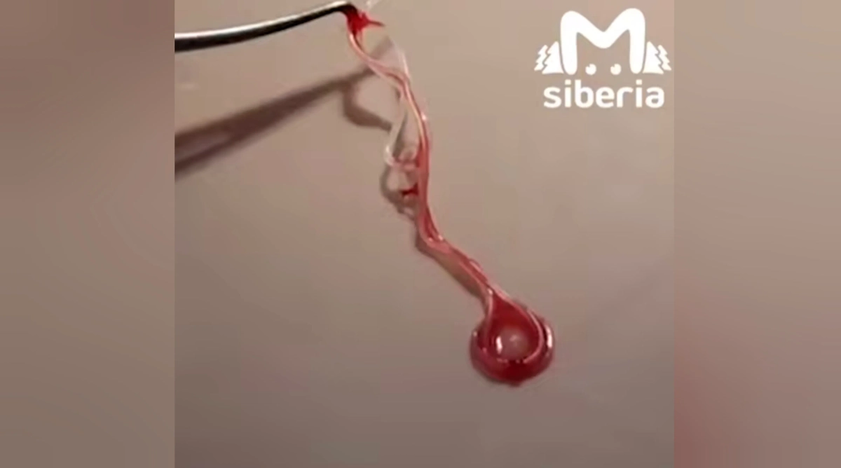 Паразит. Фото © Telegram / Mash Siberia