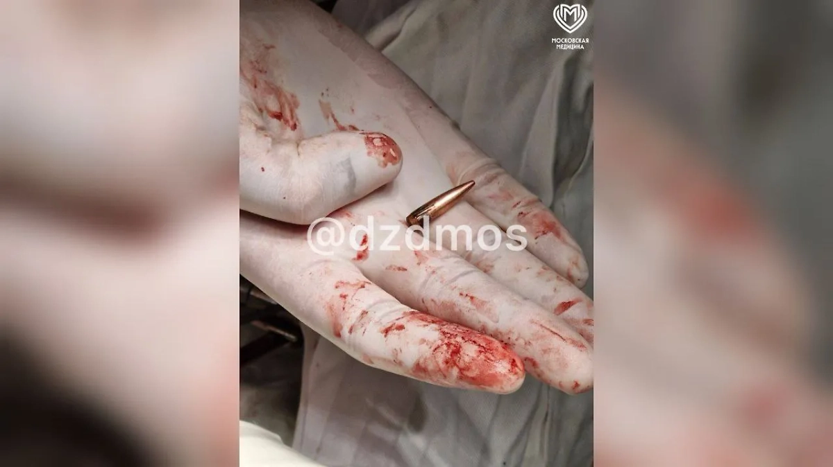 Из Курской области в Москву доставили раненного с пулей в вене. Фото © Telegram / Московская медицина
