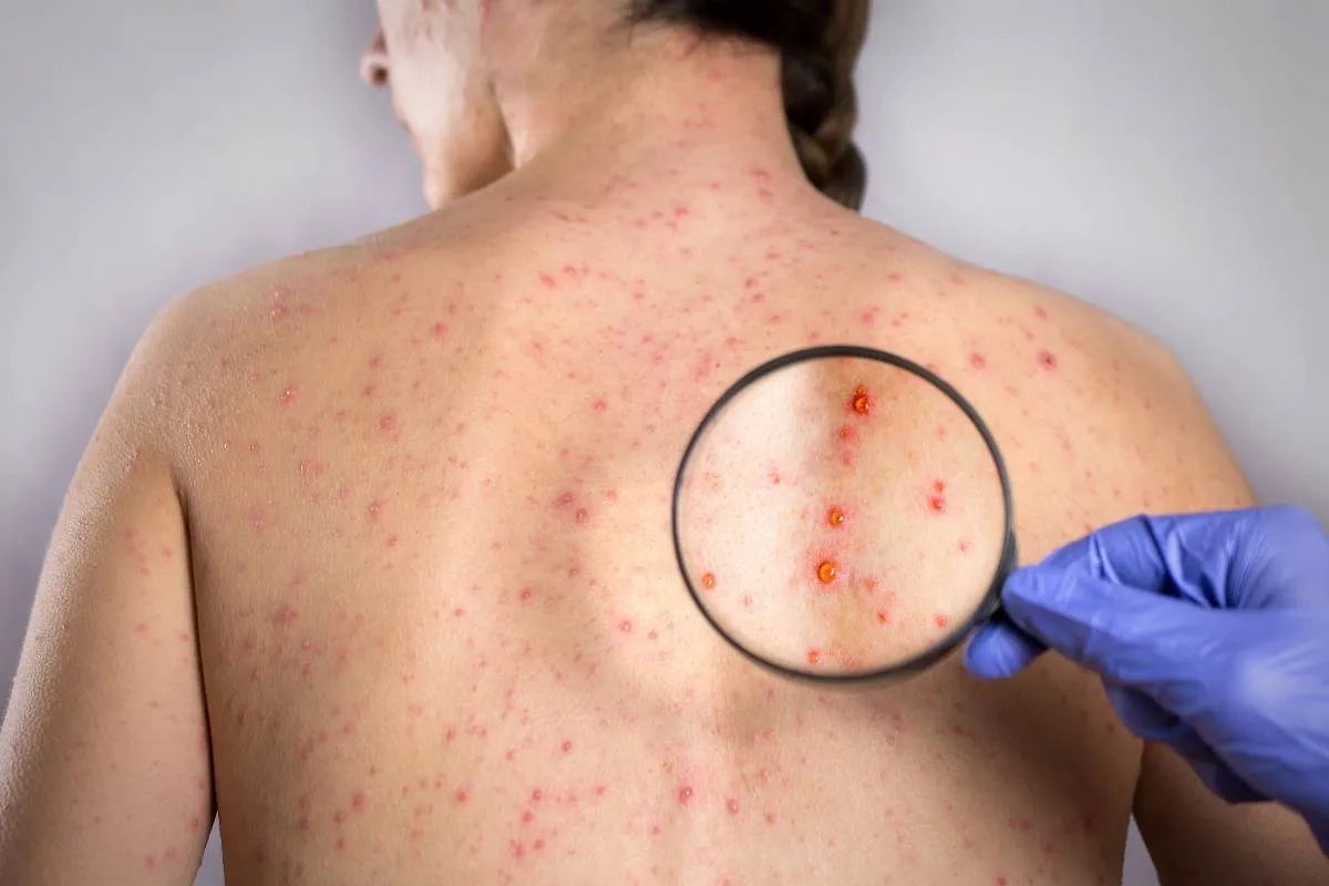 Обложка © Shutterstock / FOTODOM / OneSideProFoto