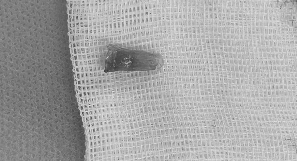 Тот самый колпачок. Фото © Предоставлено Life.ru