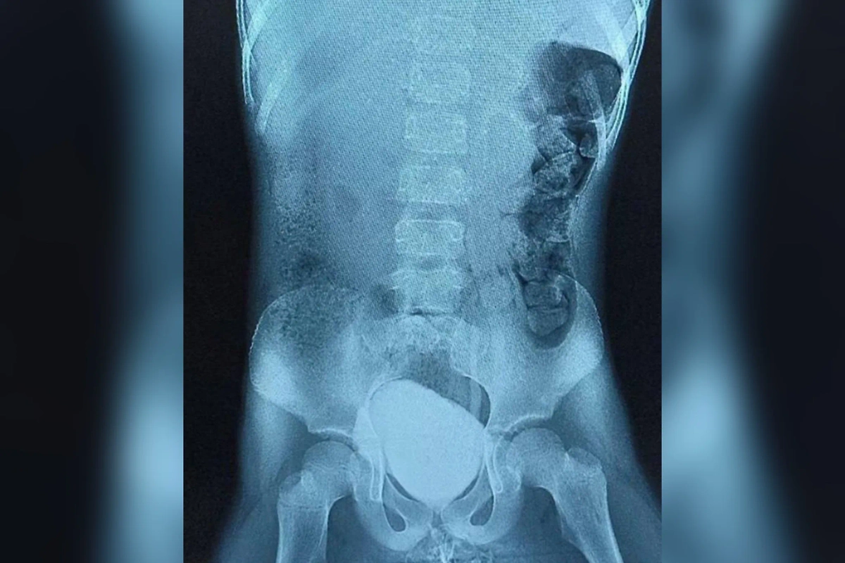 Обложка © Минздрав Московской области