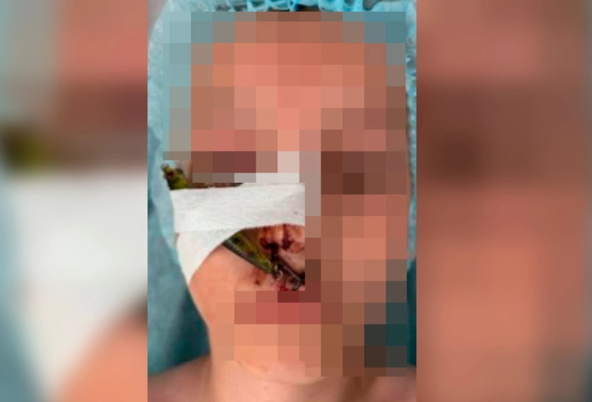 Пострадавший мальчик. Фото © Минздрав Московской области