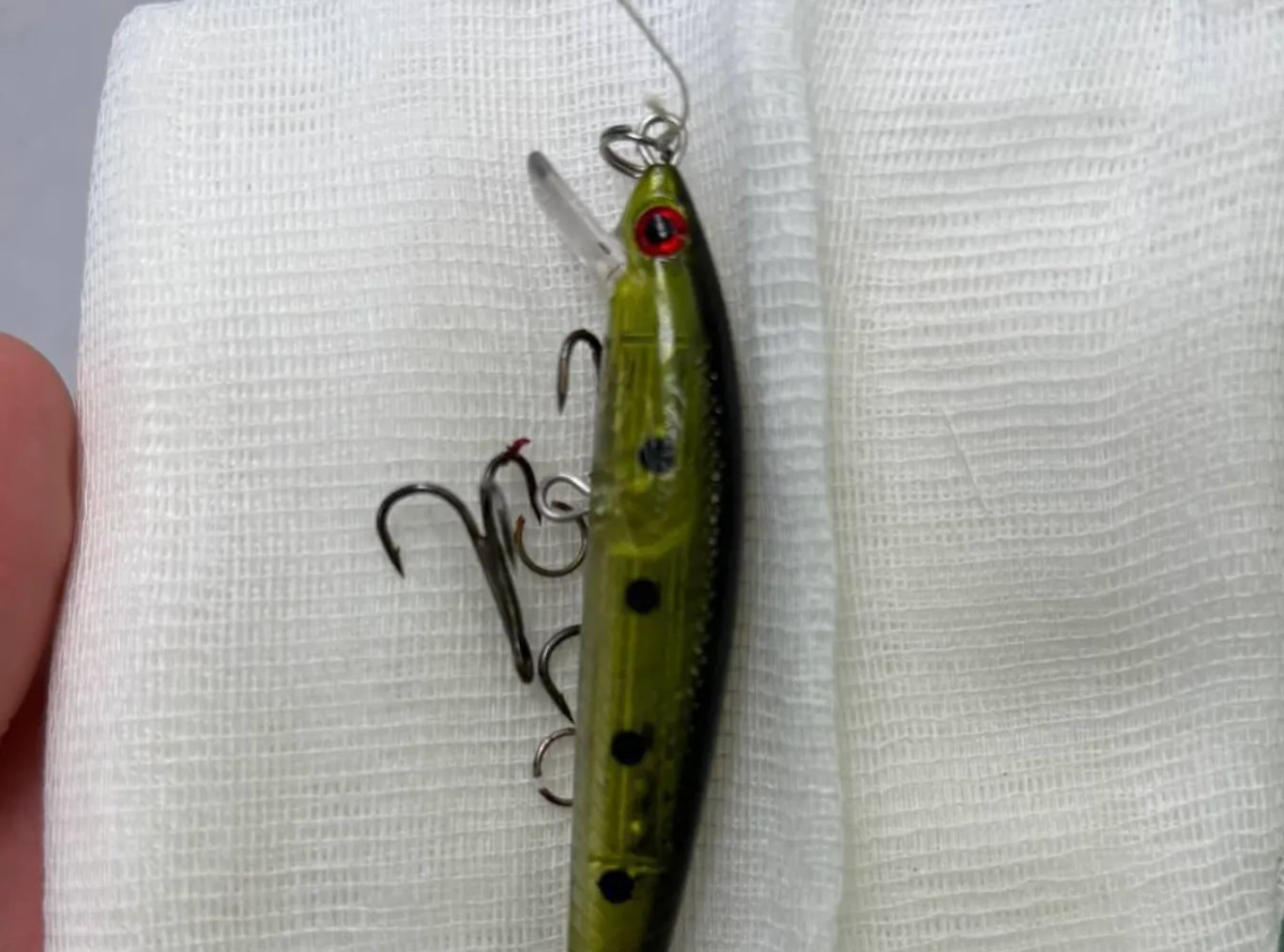 Крючок, проколовший лицо мальчику. Обложка © Минздрав Московской области