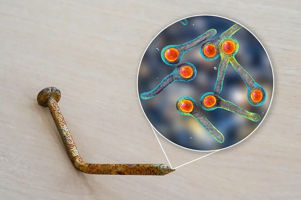 Всем, кто сделал прививку от столбняка не ранее 2018 года, добрый день. Остальным соболезнуем. Фото © Shutterstock / FOTODOM / Kateryna Kon