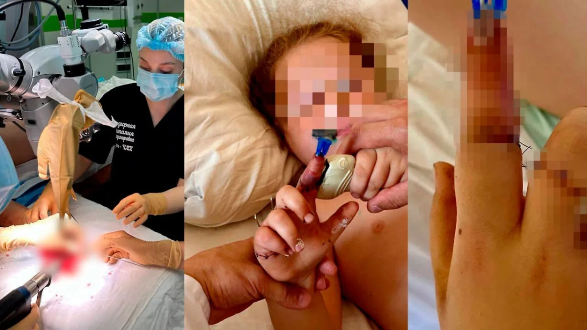 Отчим отрезал палец девочке после убийства её матери, врачи спасли ему руку. Фото © Telegram / Mash Siberia