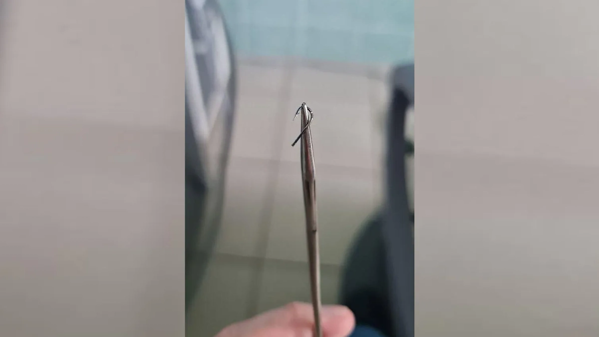 Тот самый крючок, который вонзился школьнику в нос. Фото © Telegram / ПКБ им. проф. Розанова В.Н.