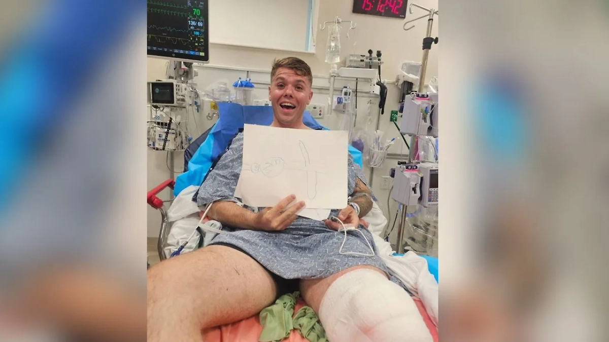 В США рыбак улыбнулся в камеру после того, как акула едва не откусила ему ногу. Фото © Х / All Things Emerald Coast