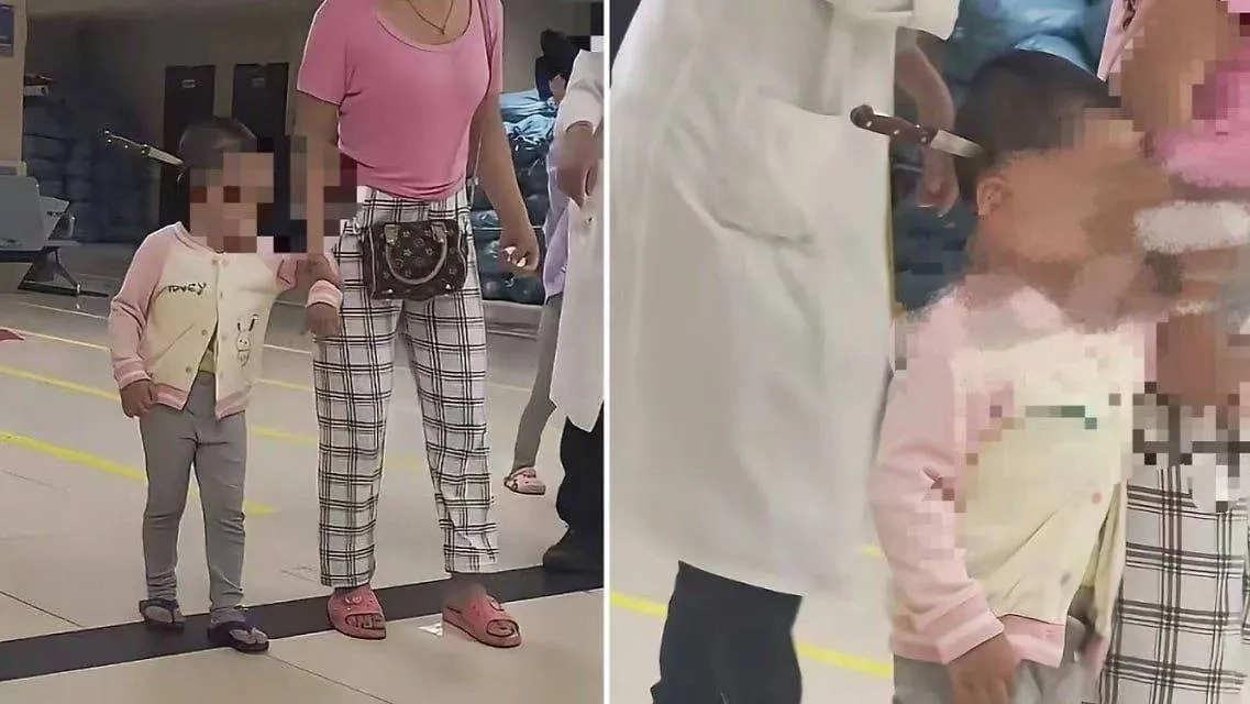 В Китае врачи спасли ребёнка, вытащив  15-сантиметровый нож из головы. Обложка © X / MustShareNews