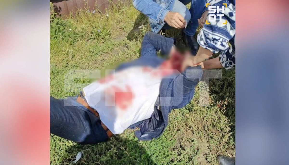 Последствия избиения Александра Помогайбо. Фото © SHOT