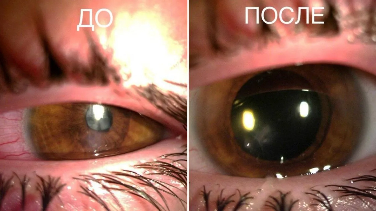 Глаз мальчика. Фото © Минздрав Московской области