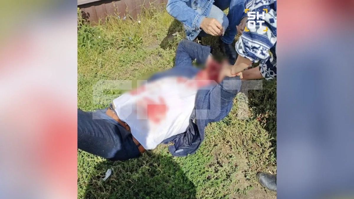 Последствия избиения Александра Помогайбо. Фото © SHOT