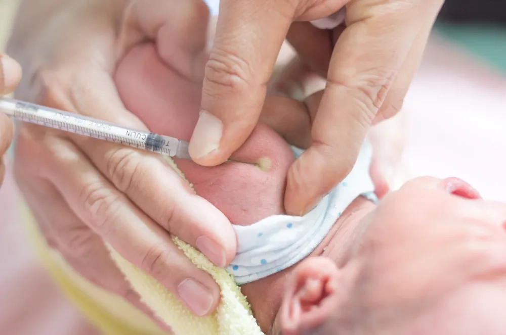 Как отличить поколение X от миллениала или зумера? По рубцу от БЦЖ, очевидно. Шрамы украшают настоящего советского человека. Фото © Shutterstock / FOTODOM / Akkalak Aiempradit