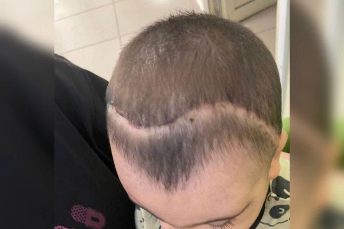 Малыш с деформацией черепа. Обложка © Telegram / «Московская медицина»