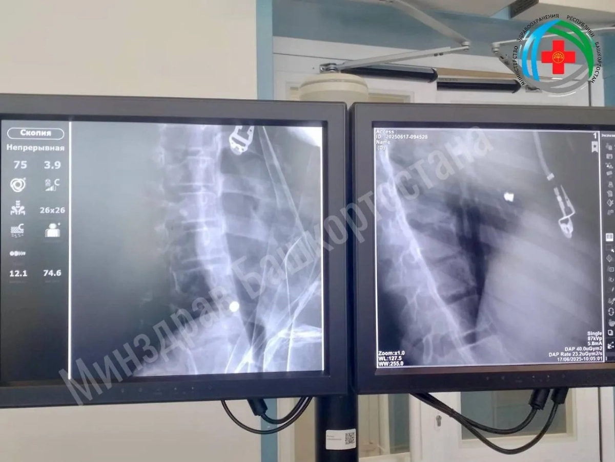 Ранение школьница получила из-за «несчастного случая с пневматическим оружием». Фото © Telegram / Айрат Рахматуллин