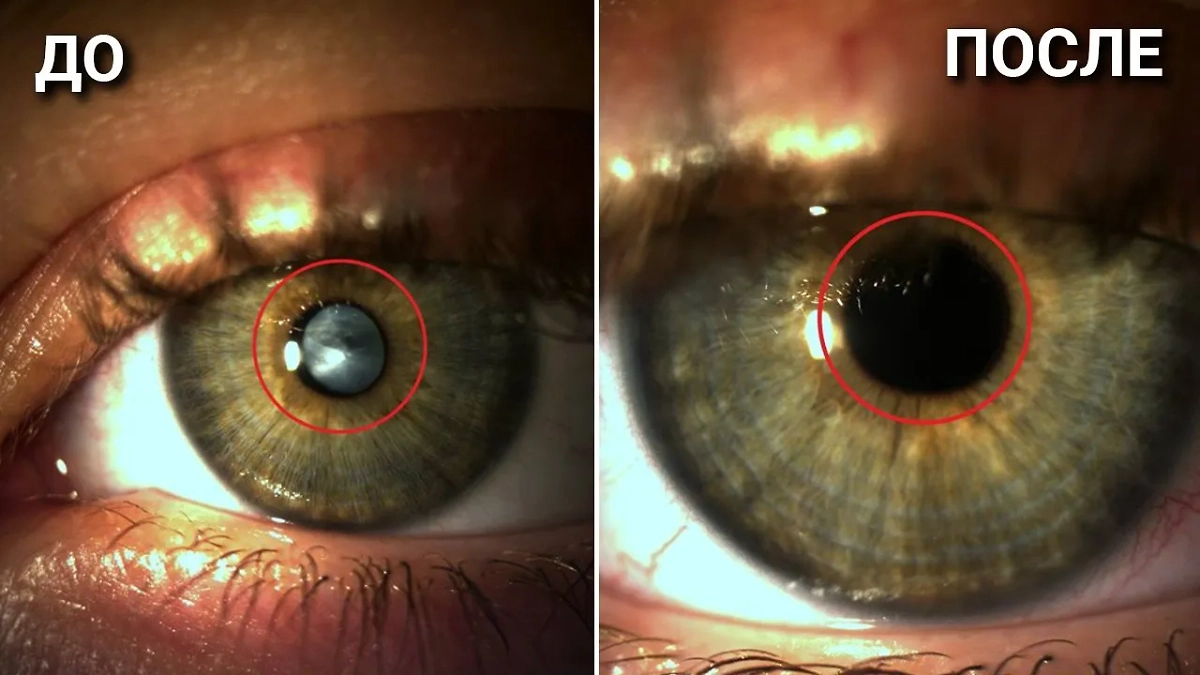Результат операции. Фото © Telegram / Детский центр им. Рошаля