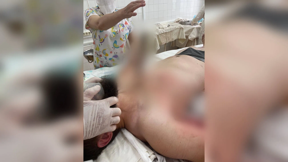 В Дагестане врачи спасли строителя, который упал грудью на арматуру. Фото © Telegram / Минздрав РД