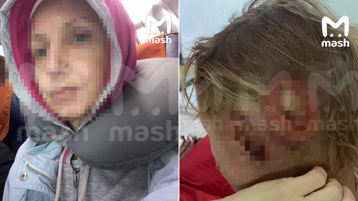 Российская туристка начала вести себя как трёхлетний ребёнок после того, как упала у бассейна в Таиланде. Фото © Telegram / Mash