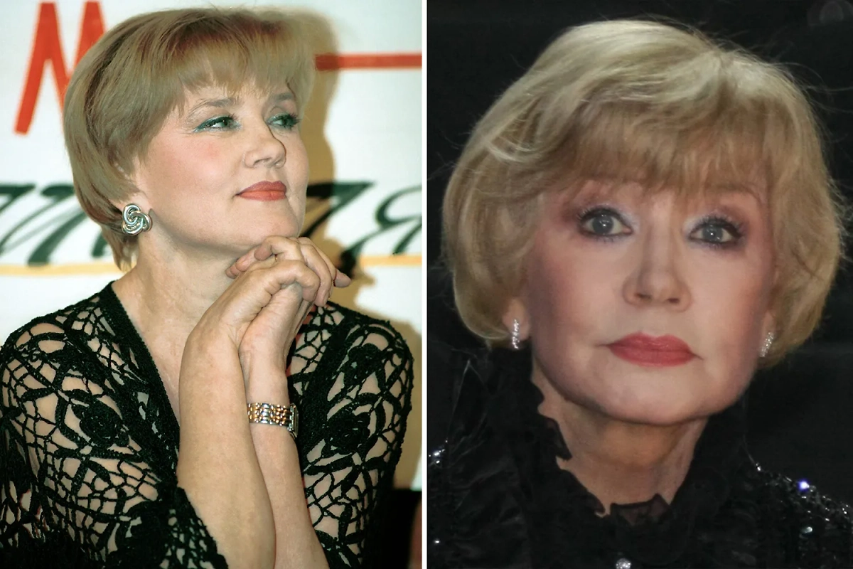 Пластические операции российских звёзд, которые закончились провалом. Фото © ТАСС / Александр Чумичев, Вадим Тараканов