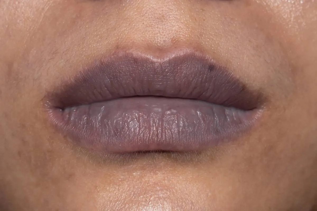 Как определить болезнь по состоянию кожи лица и глаз. Фото © Shutterstock / FOTODOM / Zay Nyi Nyi