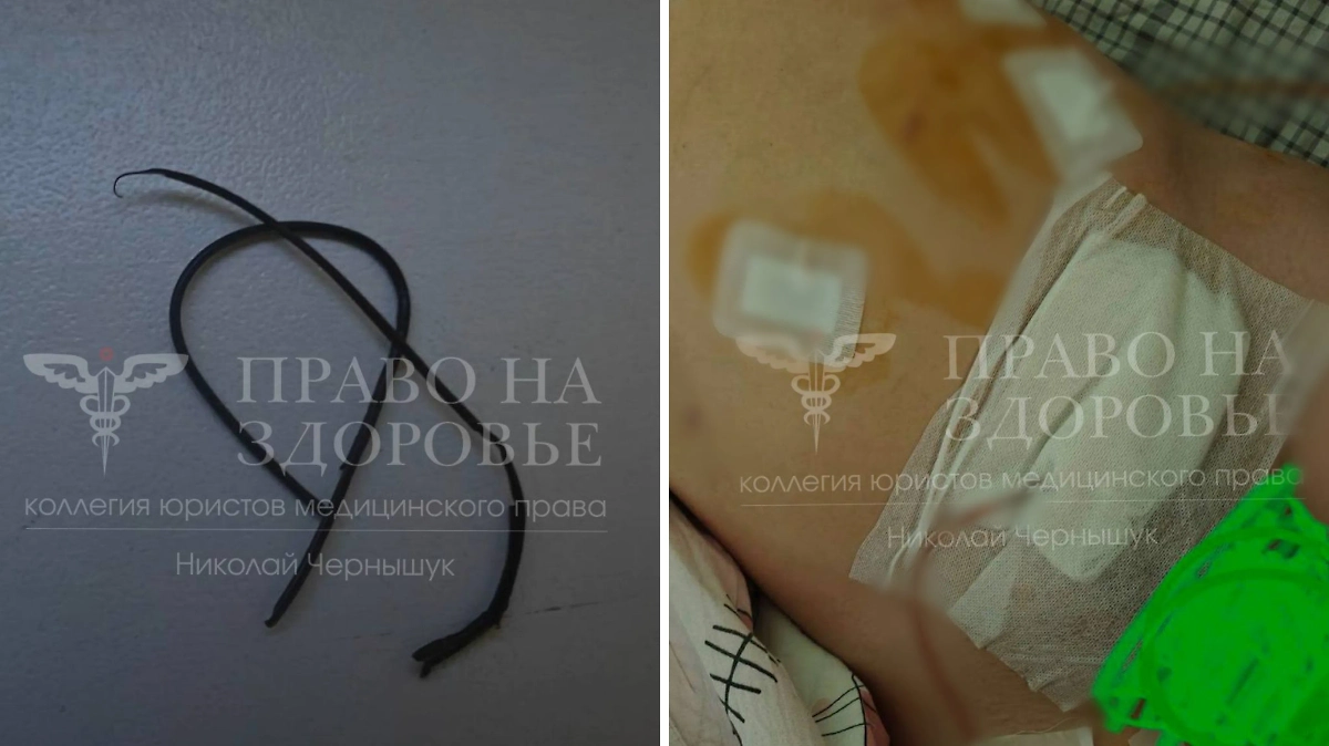 Фото © Telegram / МЕДАДВОКАТ | Чернышук Николай