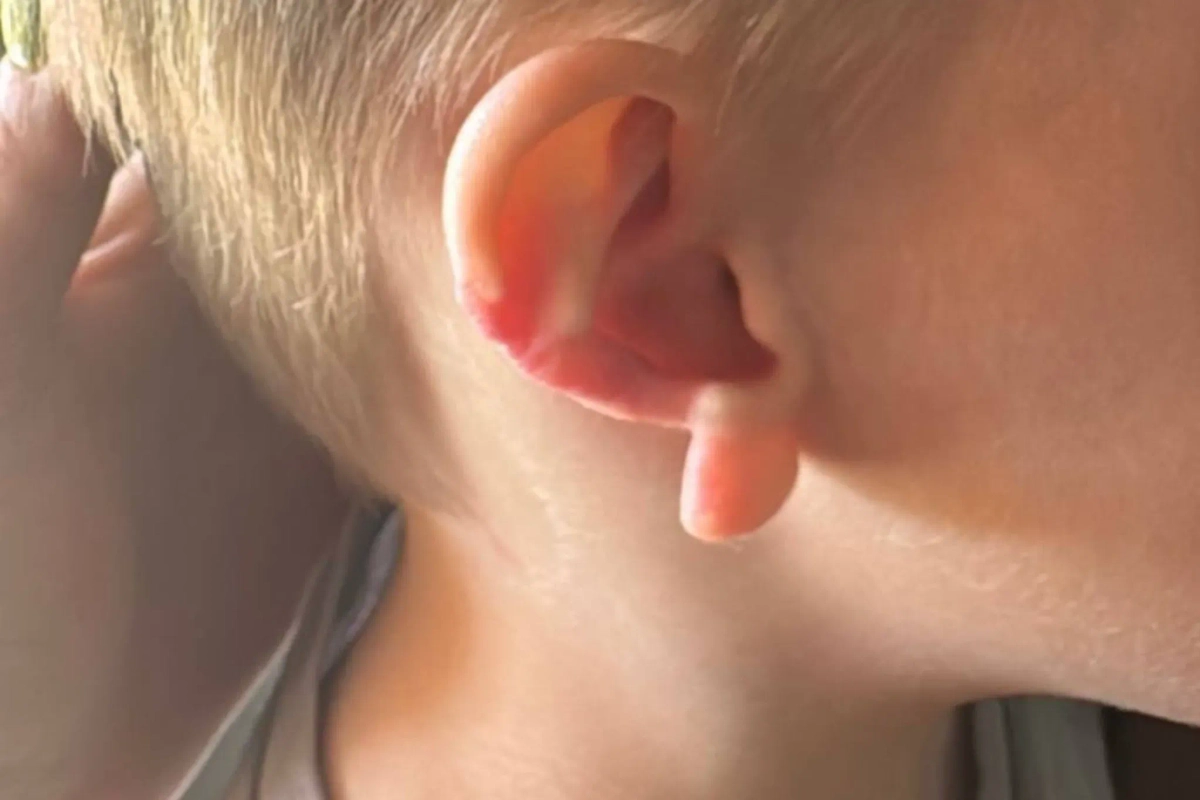 Пострадавший ребёнок. Фото © Telegram /Прокуратура Челябинской области