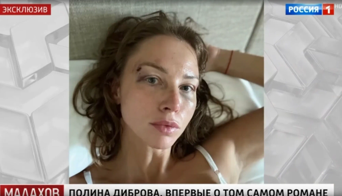 Полина Диброва. Фото © Кадр из шоу «Малахов», телеканал «Россия-1» 