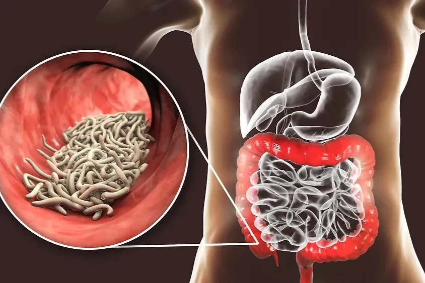 Паразитарные инфекции — меры предосторожности. Фото © Shutterstock / FOTODOM / Kateryna Kon
