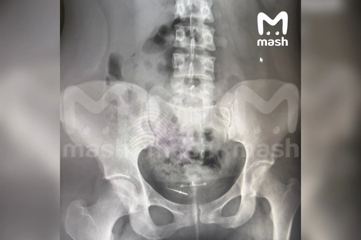 Обложка © Mash