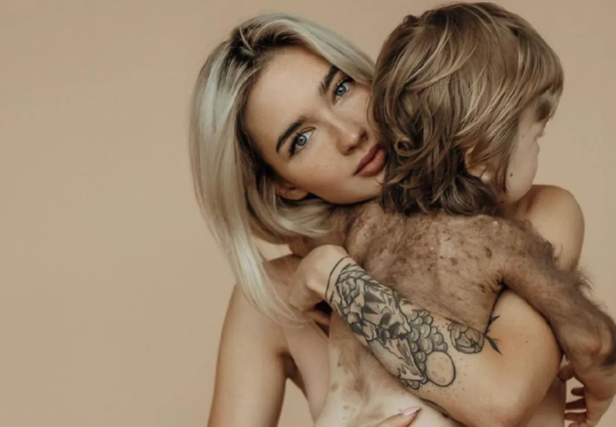 Мезенова с сыном до операции, мальчику сейчас 7 лет. Фото © Instagram (признан экстремистской организацией и запрещён на территории Российской Федерации)/ mezenova