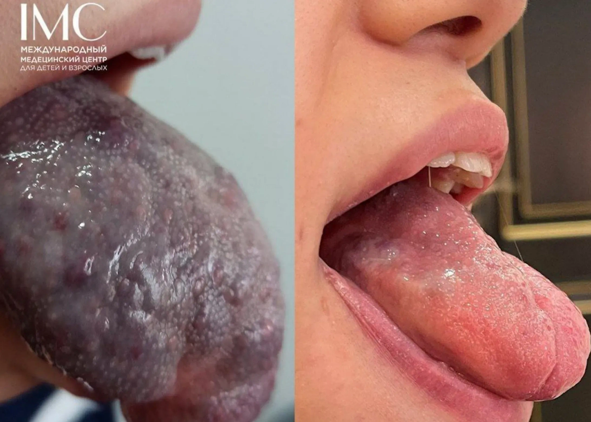 Фото © IMC (Международный медицинский центр для детей и взрослых в Дагестане)