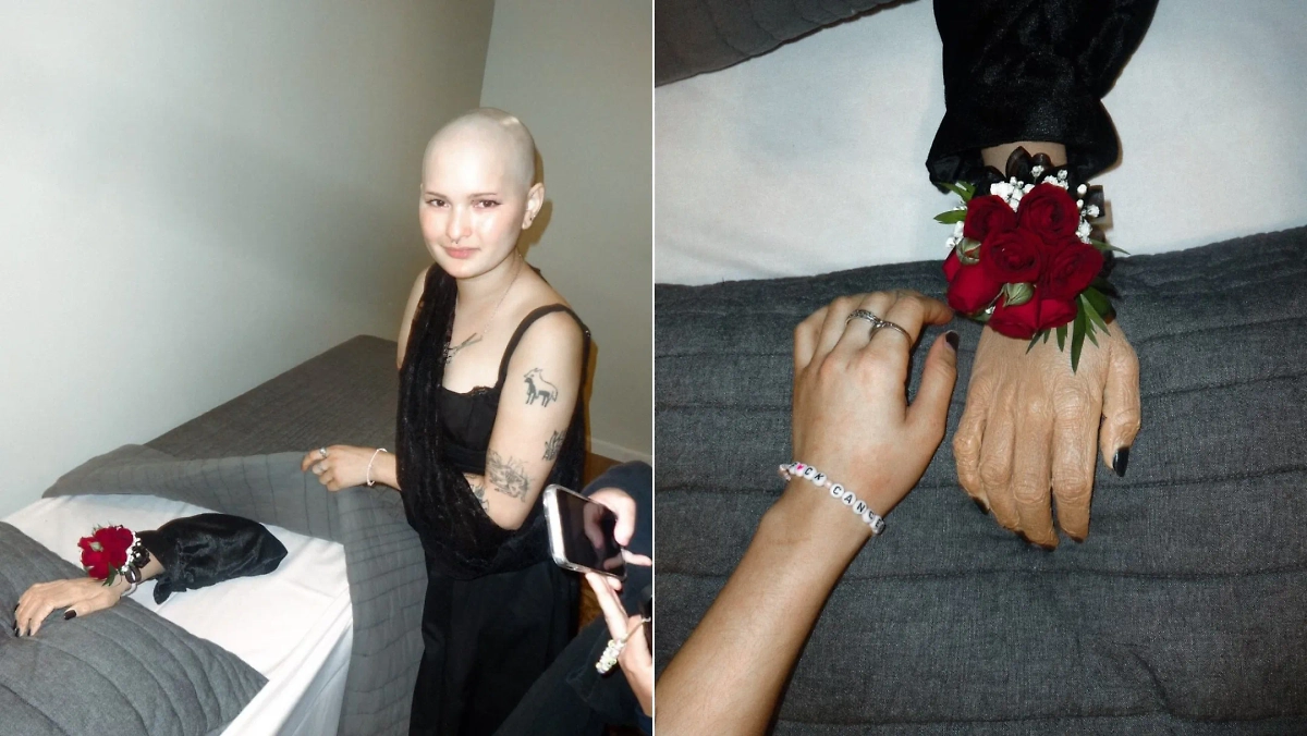 Американка простилась с рукой. Фото © Instagram (признан экстремистской организацией и запрещён на территории Российской Федерации) / semibionicbarbie