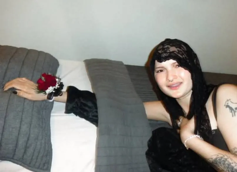 Девушке ампутировали руку из-за прогрессирующей онкологии. Фото © Instagram (признан экстремистской организацией и запрещён на территории Российской Федерации) / semibionicbarbie