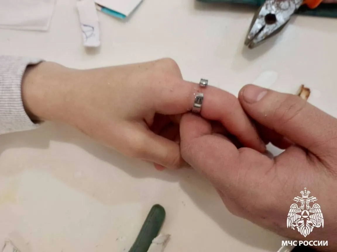 Кольцо пришлось распилить. Фото VK / МЧС России 