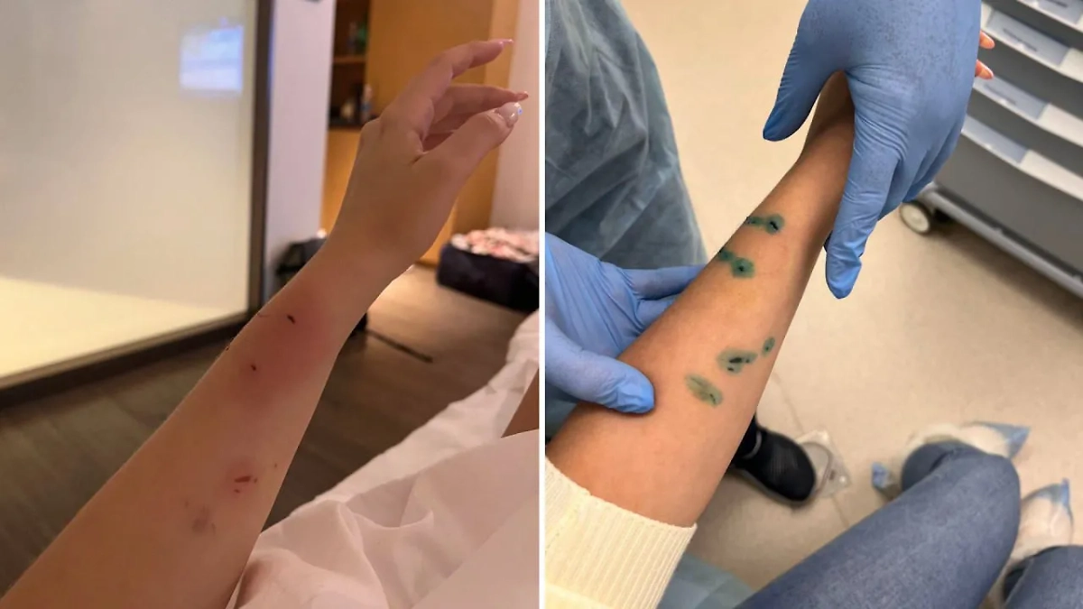 Укусы дикой обезьяны. Обложка © Telegram / Московская медицина