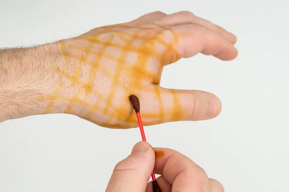 Сеточка из йода в Советском Союзе лечила от всех болезней. Фото © Shutterstock / FOTODOM / AntonSAN