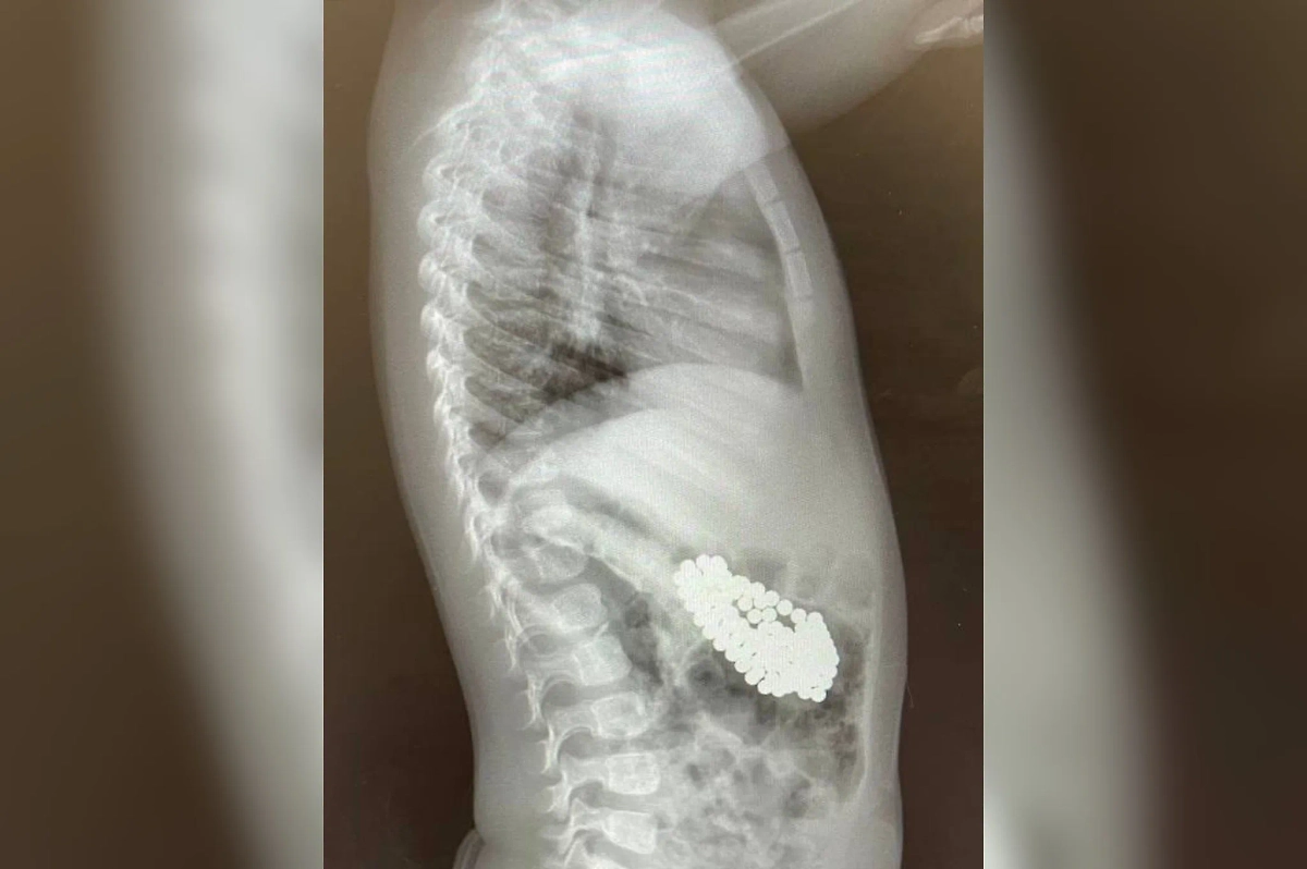 Мальчик съел 130 магнитов и литиевую батарейку и попал на операционный стол. Обложка © Минздрав Московской области