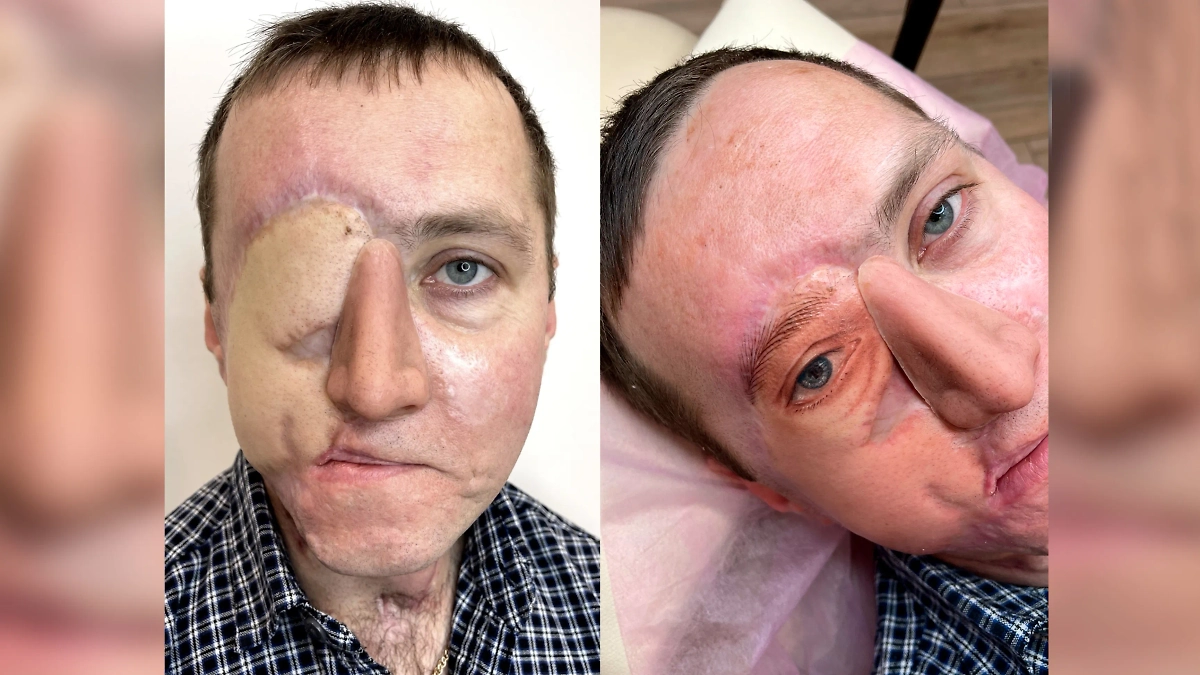 Чудо на кончике иглы: как татуировки помогают людям снова стать собой. Фото © Личный архив Аллы Ромазановой.