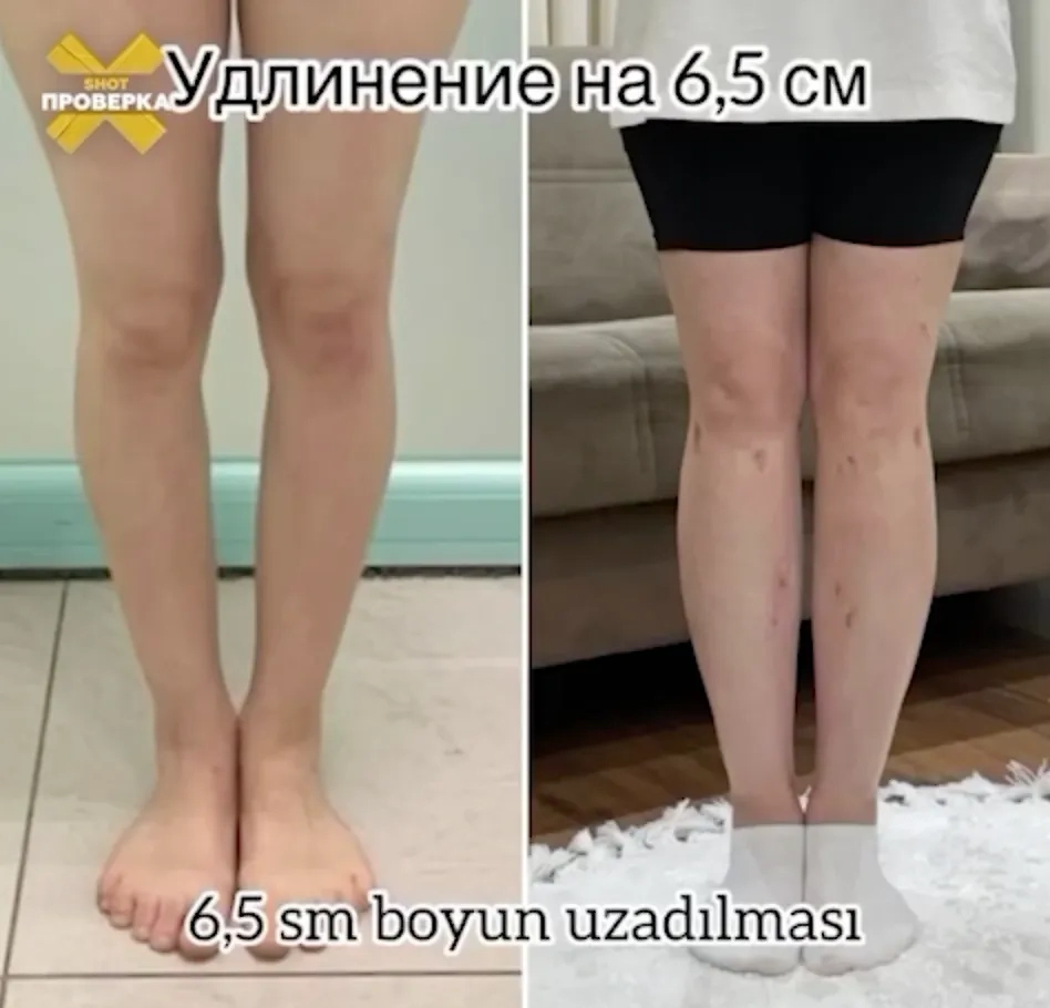 Фото © SHOT ПРОВЕРКА 