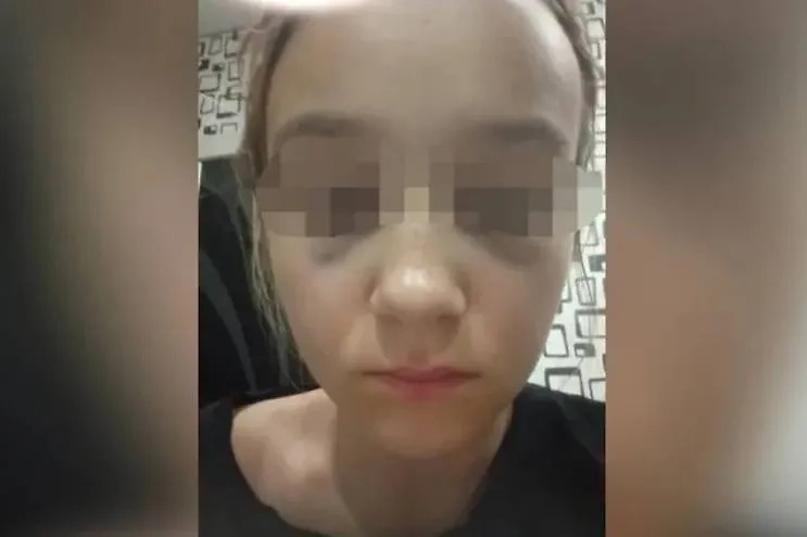 Пострадавшая школьница из Забайкалья. Обложка © Предоставлено kp.ru