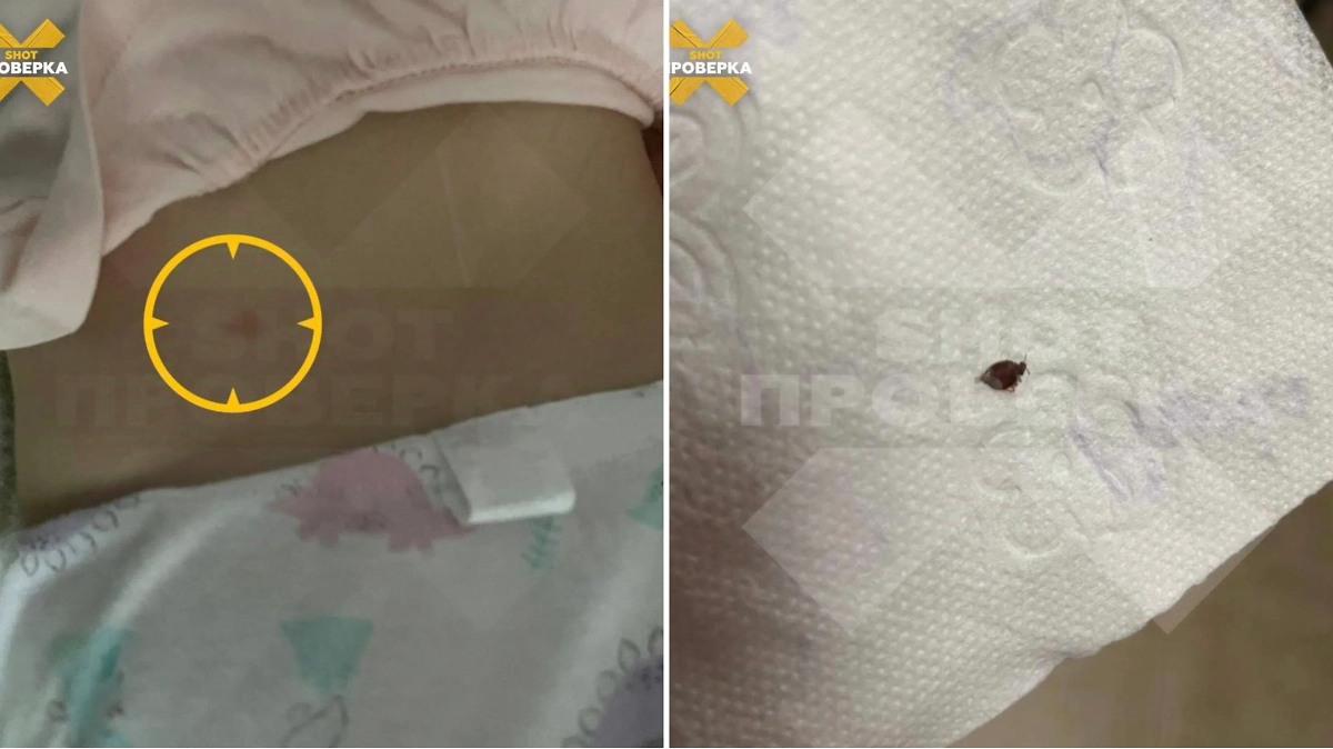 Петербуржец, купивший матрас и кровать, обнаружил клопов. Фото © Telegram / SHOT ПРОВЕРКА