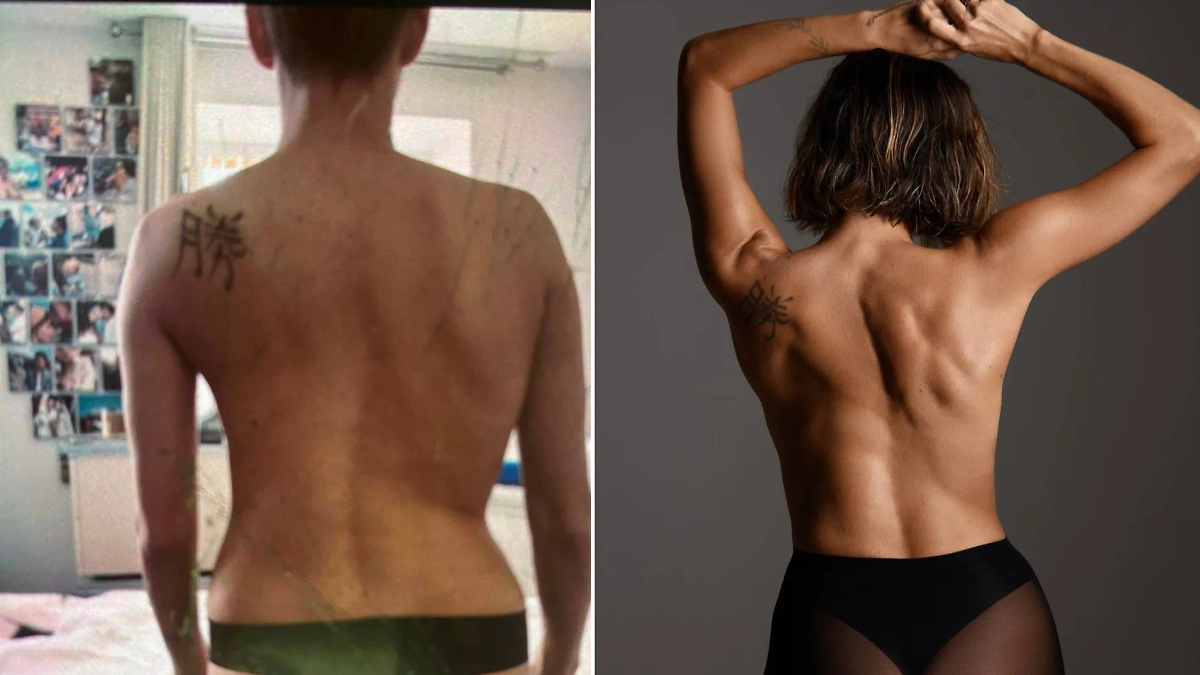 Тодоренко показала результат борьбы со сколиозом. Фото © Telegram / Регина Путешественница