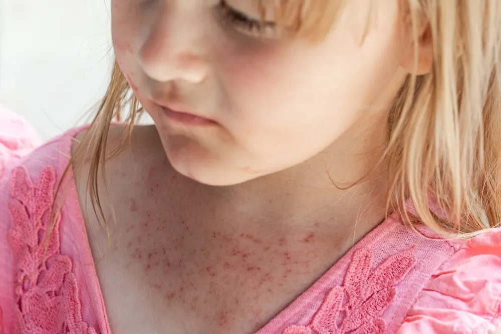 Обложка © Shutterstock / FOTODOM/ Mariya Surmacheva