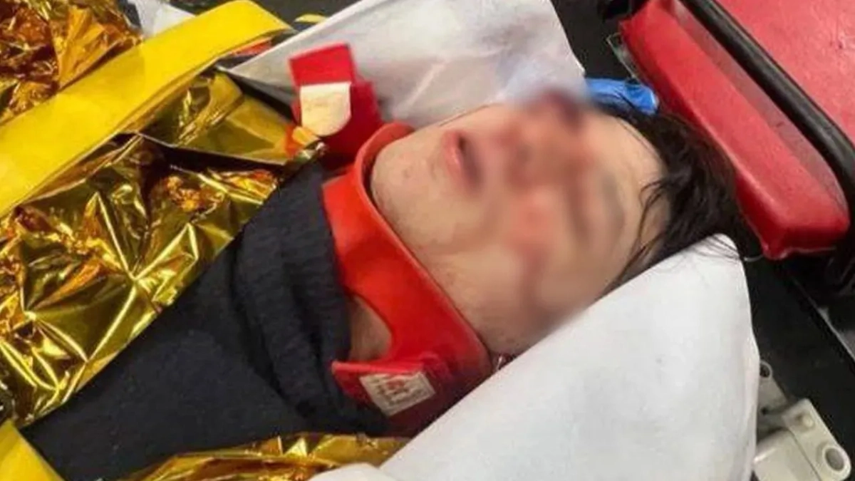 Vacio после падения. Фото © Instagram (соцсеть запрещена в РФ; принадлежит корпорации Meta, которая признана в РФ экстремистской) / onlybimba