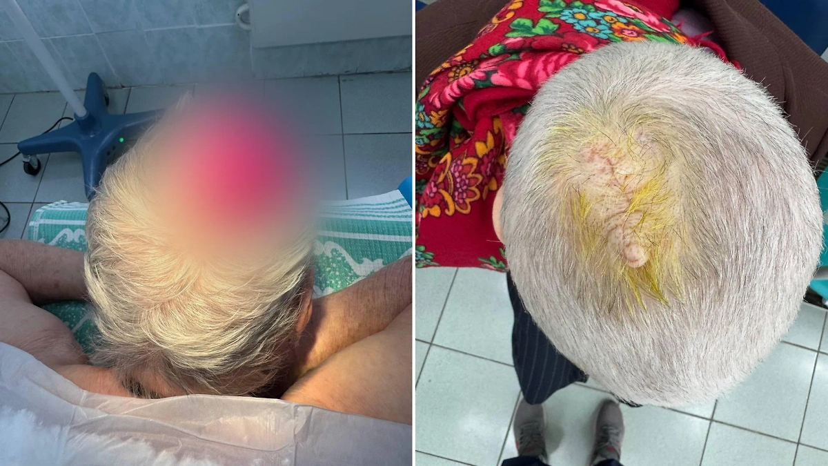 Женщина, которой врачи удалили кисту. Фото © Предоставлено Life.ru