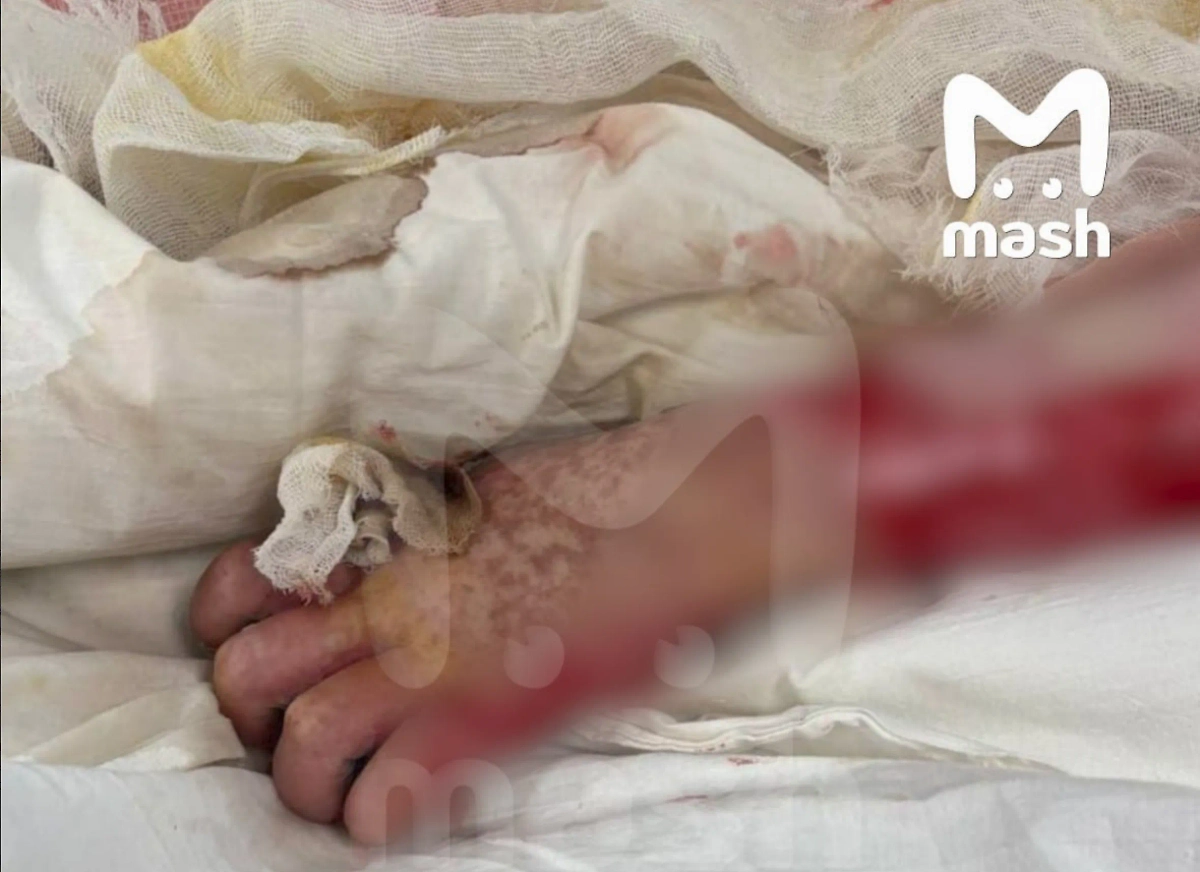 Фото © Telegram / Mash