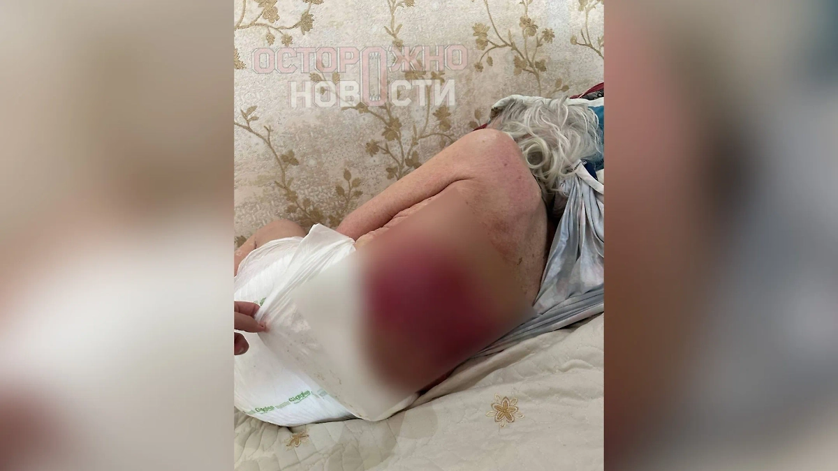 Состояние пенсионерки сейчас очень тяжёлое. Фото © Telegram / Осторожно, новости